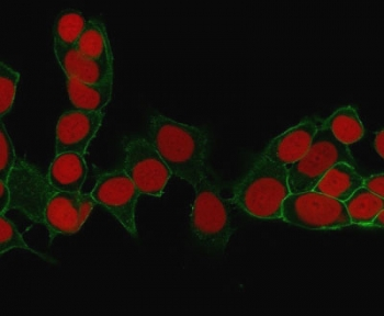 EpCAM Antibody (Extracellular domain)