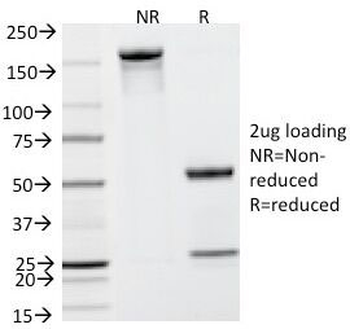 PSA / Prostate Specific Antigen Antibody