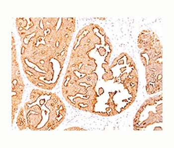 MUC1 Antibody / Mucin-1