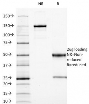 CEA Antibody / Carcinoembryonic Antigen