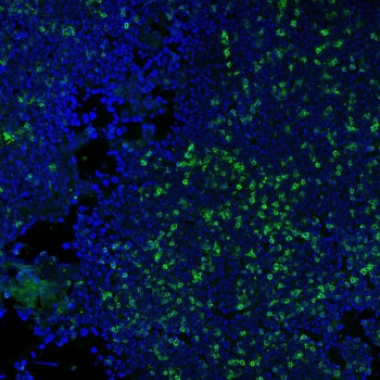 CD3 Antibody