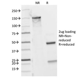 CD8 Antibody (alpha)