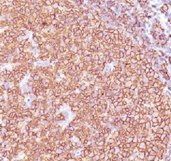 CD20 Antibody