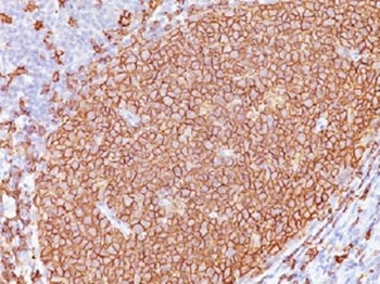 CD20 Antibody Cocktail