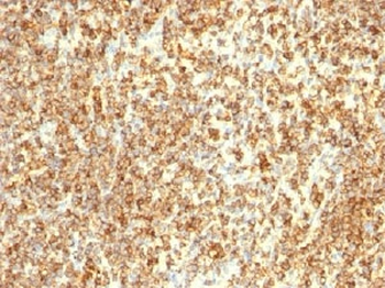 CD20 Antibody Cocktail