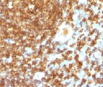 CD45RB Antibody (B-cell marker)
