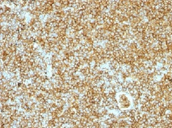 CD45RB Antibody (B-cell marker)