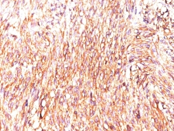 DOG1 Antibody / TMEM16A / ANO1