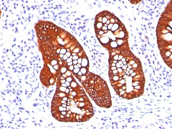 KRT19 Antibody Cocktail / Cytokeratin 19