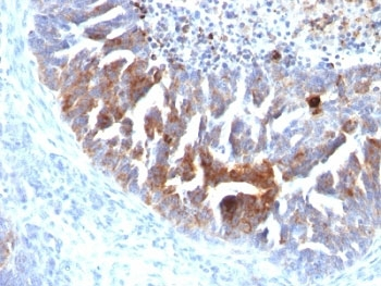 TAG-72 Antibody Cocktail