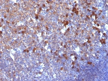 IgG Antibody