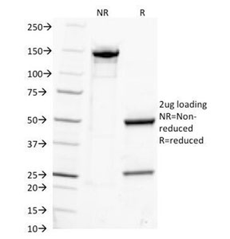 IgG Antibody