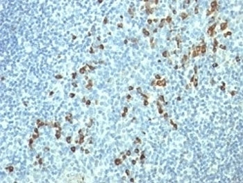 Lambda Light Chain Antibody / Lambda Antibody