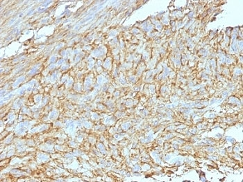 DOG1 Antibody Cocktail / TMEM16A / ANO1