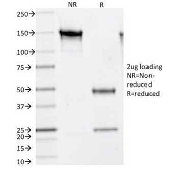 Thymidylate Synthase Antibody