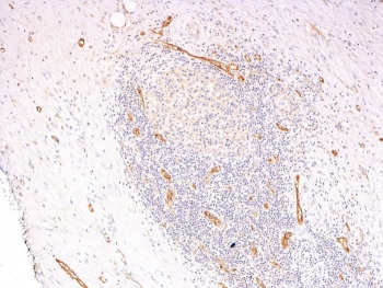 von Willebrand Factor Antibody Cocktail