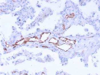 von Willebrand Factor Antibody Cocktail