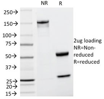 TRP1 Antibody / Tyrosinase-Related Protein-1 Antibody / TYRP1