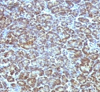 Mitochondrial Antibody