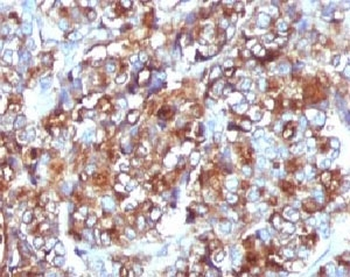 MUC1 Antibody / Mucin-1