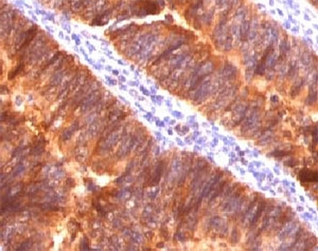 MUC1 Antibody / Mucin-1