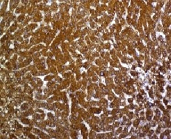 Glypican 3 Antibody / GPC3