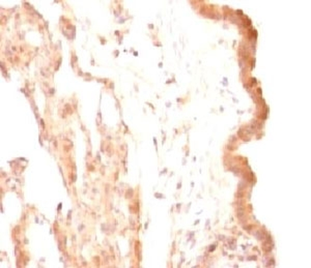 Glypican 3 Antibody / GPC3