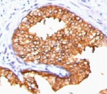 Ornithine Decarboxylase Antibody / ODC1