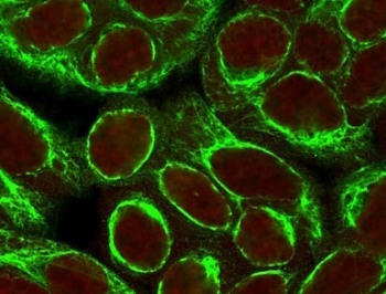 Cytokeratin 8 Antibody