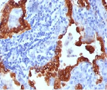 Cytokeratin 8 Antibody