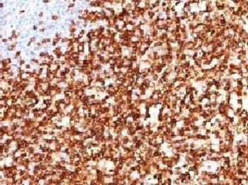 CD45RO Antibody (T-cell marker)