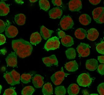 Calponin 1 Antibody