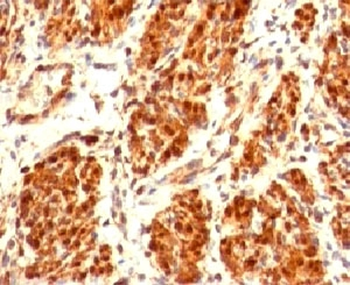 Calponin 1 Antibody