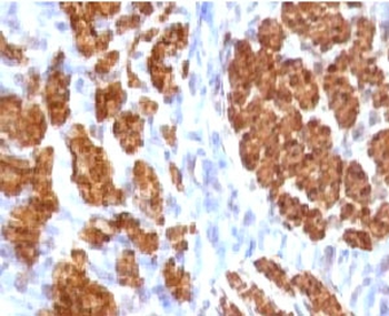 Calponin 1 Antibody