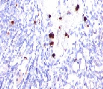 CSF3 Antibody / Granulocyte-Colony Stimulating Factor