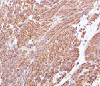 c-Kit Antibody / CD117