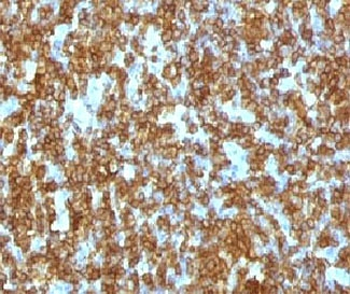 CD45RA Antibody (Leukocyte marker)