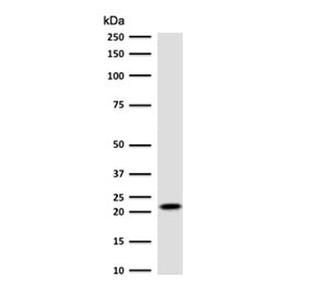 p21 Antibody / CDKN1A