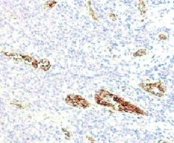 von Willebrand Factor Antibody / vWF