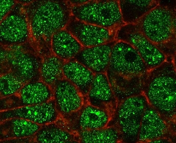 SUMO2/3 Antibody