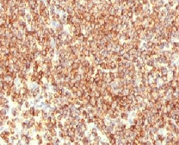 CD20 Antibody