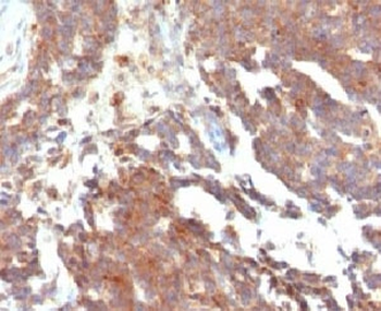 GnRH Receptor Antibody / GNRHR