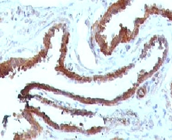 HSP27 Antibody