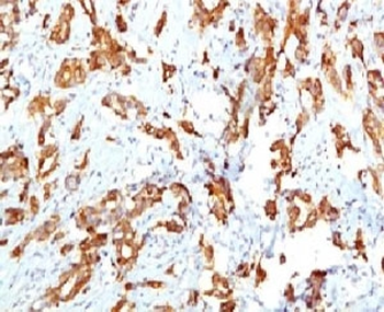 HSP27 Antibody / HSPB1