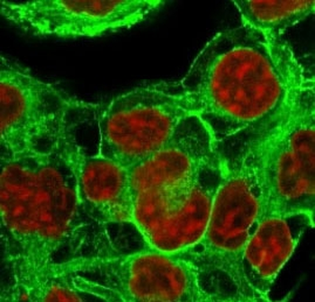 HSP27 Antibody / HSPB1