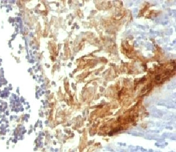 Involucrin Antibody