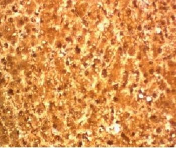 Arginase 1 Antibody