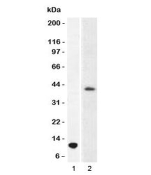 Arginase 1 Antibody