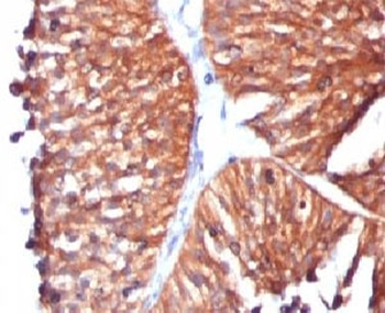 HSP60 Antibody / HSPD1