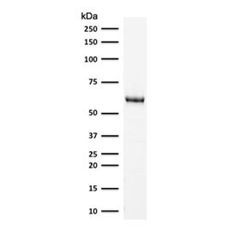 HSP60 Antibody / HSPD1